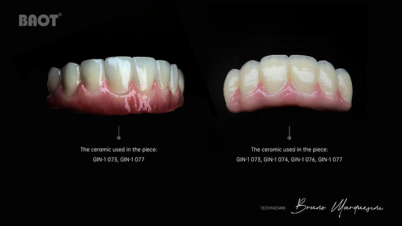 dental porcelain material use for gingiva margin