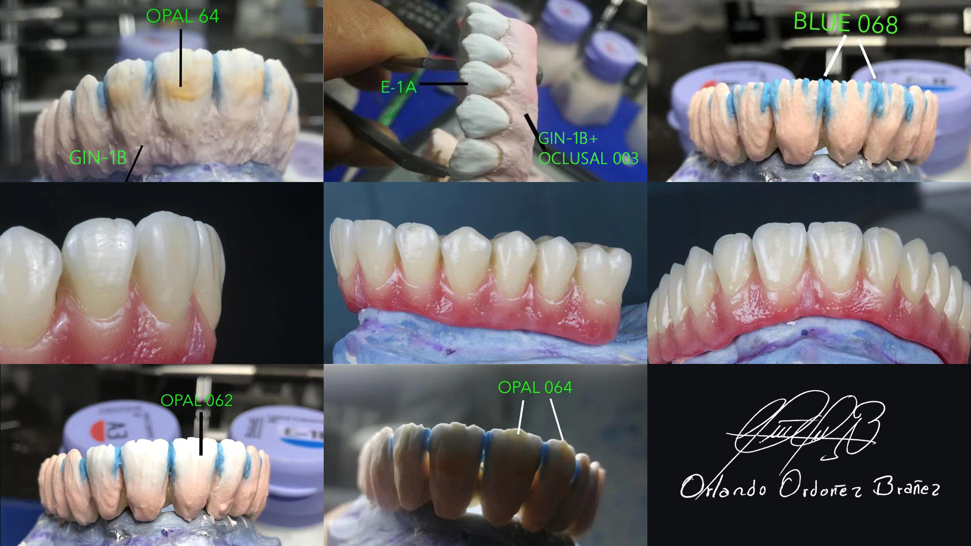 opal occlusal dental ceramic powder