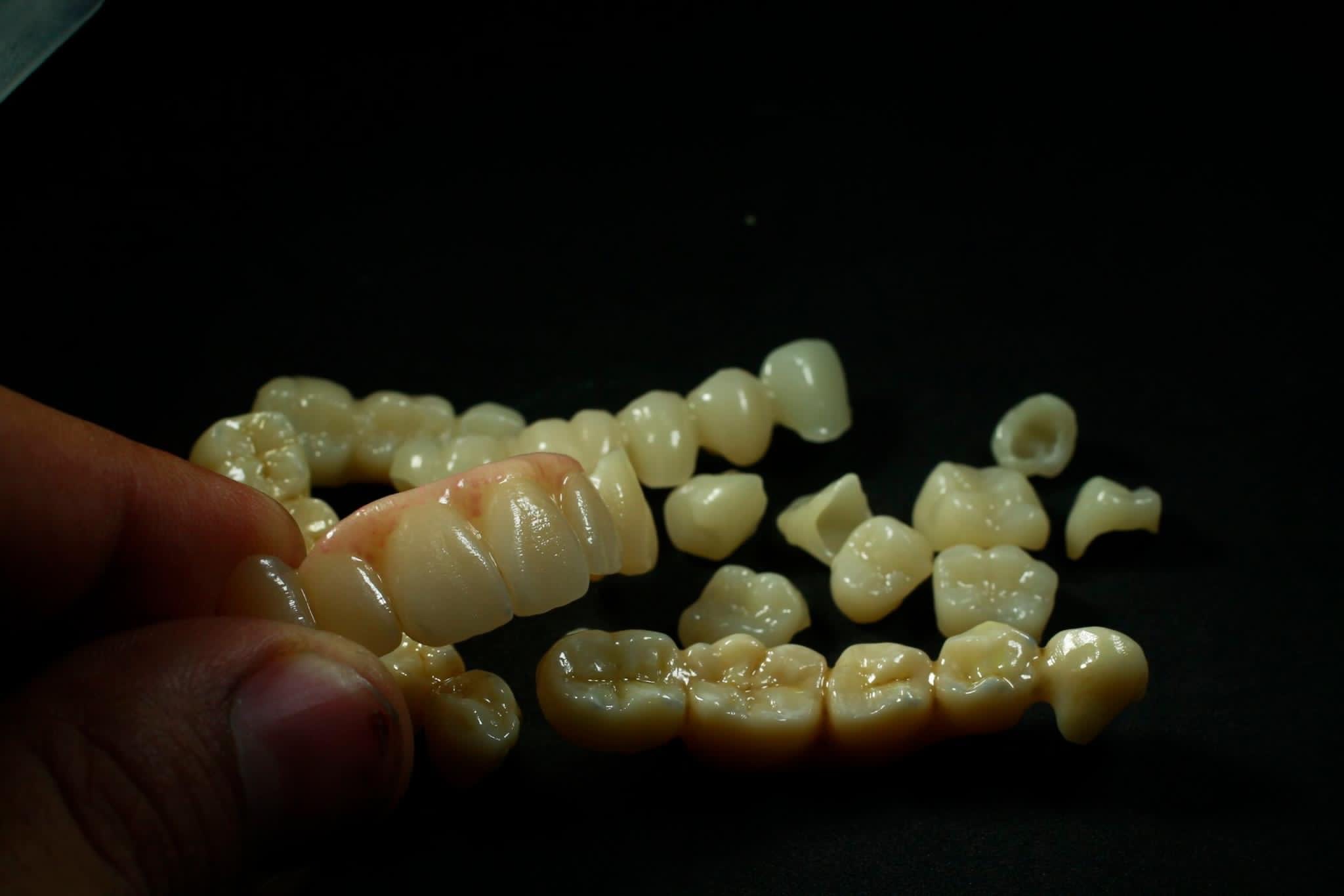 Pó de porcelana de material de laboratório dentário