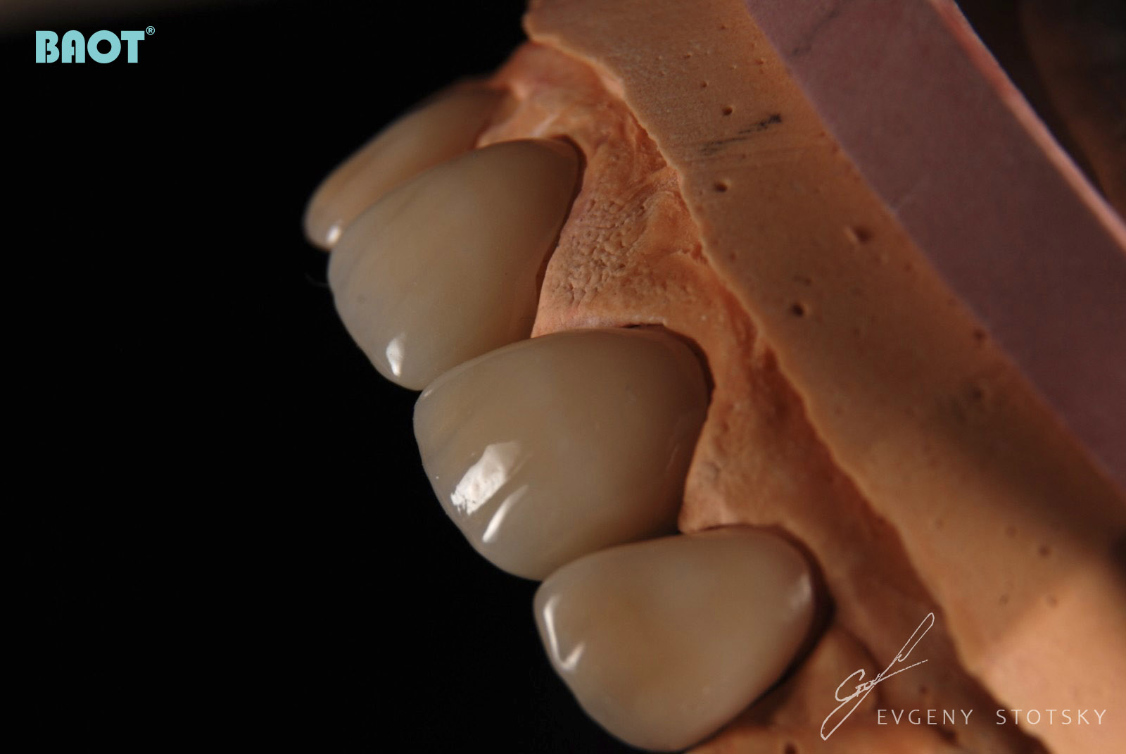 Pó de material cerâmico dental para restauração