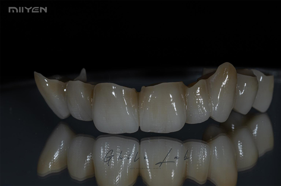 MIIYEN zircônia 3D Pro para Odontologia
