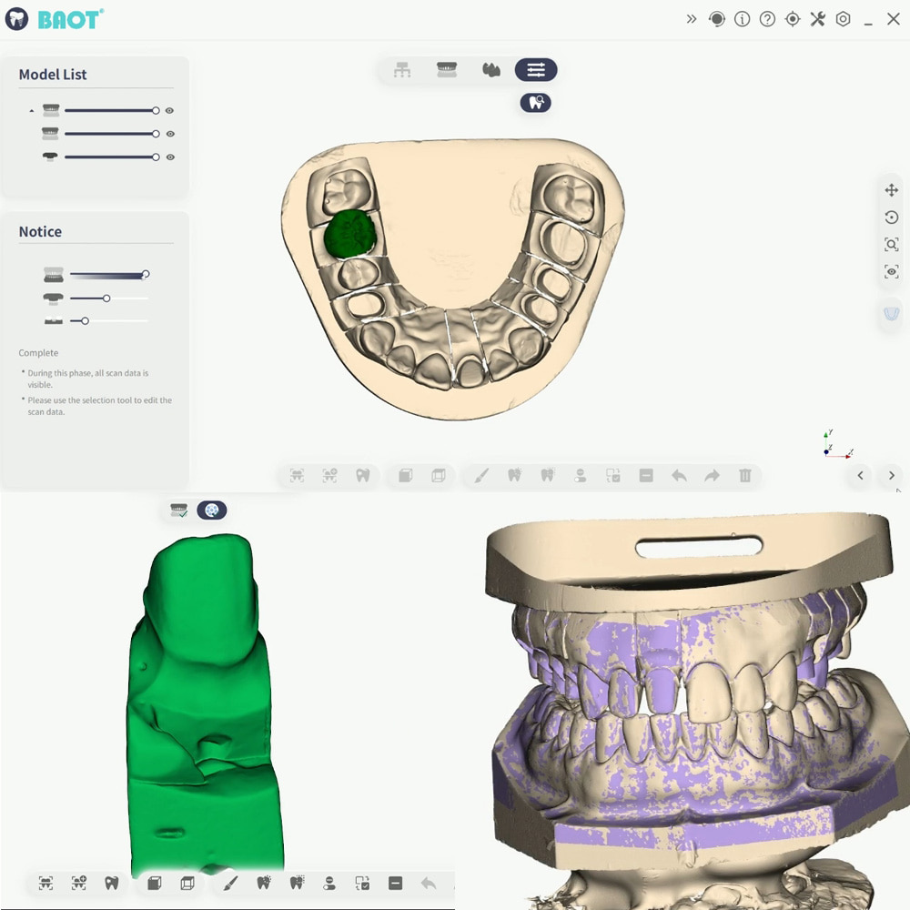 Máquina de scanner 3D odontológico Varredura da mandíbula inferior