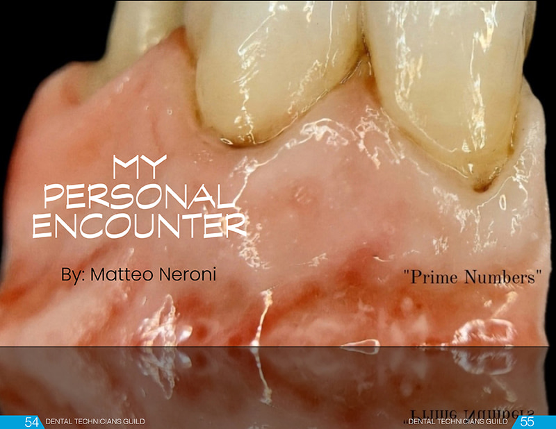 BAOT Zirconia Block Stain and Glaze Application