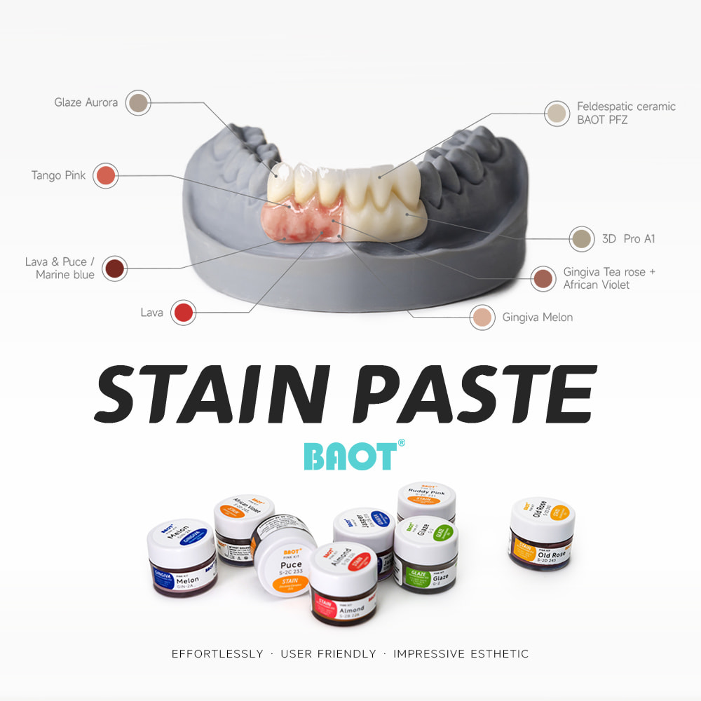 Universal glaze paste for dental zirconia crowns