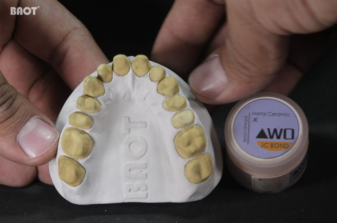 Como evitar retrabalho em restaurações dentárias