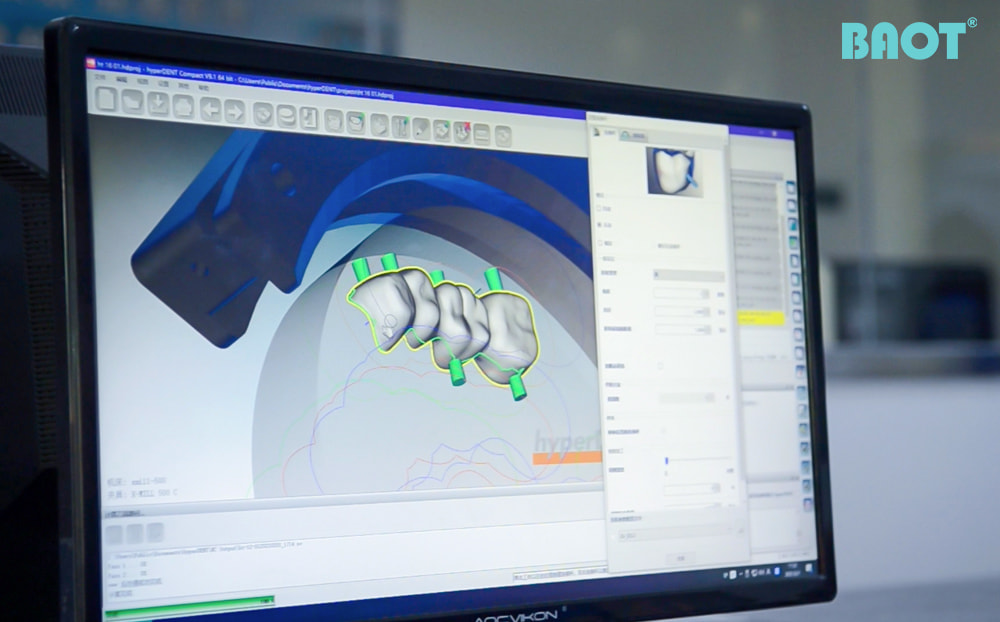 O papel dos blocos de zircônia no futuro da odontologia digital